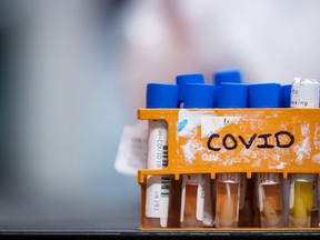 Specimens to be tested for COVID-19 are seen at LifeLabs in Surrey, B.C., on Thursday, March 26, 2020.