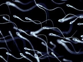 Sperm