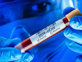 Nurse holds blood test tube for 2019 nCoV analysis. Chinese Corona Virus Blood Test Concept