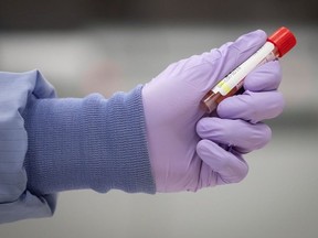 A laboratory technical assistant handles a specimen to be tested for COVID-19 after scanning its barcode upon receipt at LifeLabs in Surrey, B.C., on Thursday, March 26, 2020.