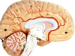 A file photo showing an image of a brain.