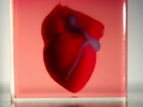 Researchers 3D-print heart from human patient's cells.