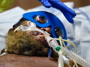 Health-care workers care for a COVID-19 patient in the ICU who is intubated and on a ventilator at the Humber River Hospital during the COVID-19 pandemic in Toronto on Dec. 9, 2020.