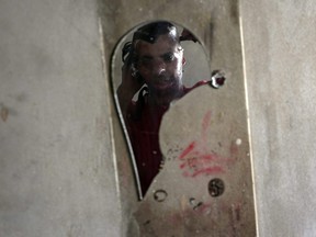 Palestinian man Ahmed Al-Natour, 34, who has severe facial burns, is reflected in a mirror as he wears a 3D transparent face mask provided by Medecins Sans Frontieres (MSF), at his home in Gaza City Feb. 9, 2021.