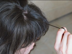 A reader who suffers from trichotillomania following childhood trauma writes to Amy seeking help.