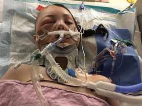 In this photo provided by the Driscoll family, Alyssa is pictured at Sick Kids hospital suffering from critical injuries.