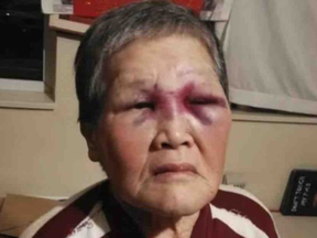 Xiao Zhen Xie, 76, fought back when she was attacked by a stranger in San Francisco on Wednesday, March 17, 2021.