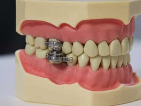 The DentalSlim.