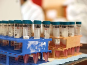 Swabs from patients participating in the Novavax phase 3 COVID-19 clinical vaccine trial await testing at the UW Medicine Retrovirology Lab at Harborview Medical Center on Feb. 12, 2021 in Seattle, Wash.