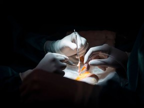 Surgeon Mario Alvarez Maestro (R) and an assistant prepare a kidney for a renal transplantation on patient Juan Benito Druet at La Paz hospital in Madrid on February 28, 2017.