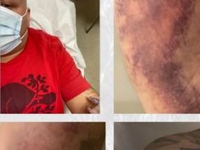 Jason Schweitzer suffered serious injuries when he was attacked by an assailant with a metal baseball bat. These images are from the 'GoFundMe' page set up to raise funds for him.