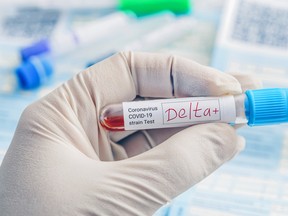 A positive blood sample for the new variant detected of the COVID strain called DELTA.