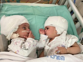 Formerly siamese Israeli twins look at one another after having undergone rare separation surgery at Soroka Medical Centre, Beersheba Sept. 5, 2021.