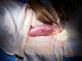 A genetically engineered pig kidney appears healthy during a transplant operation at NYU Langone in New York, in this undated handout photo.