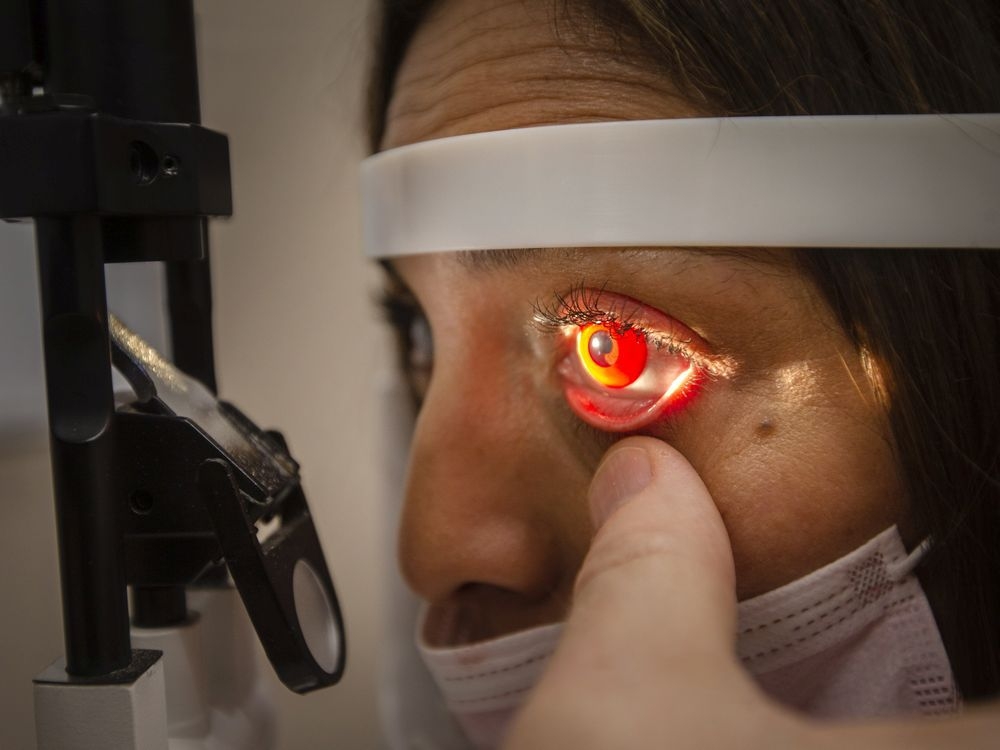 Optician warns of Halloween costume contact lens dangers Toronto Sun