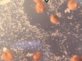 Tiny blobs made from heart and skin stem cells from the African clawed frog.