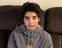 Muhammad Alzghool, 13, wird nach einem Hundeangriff mit Stichen gesehen.