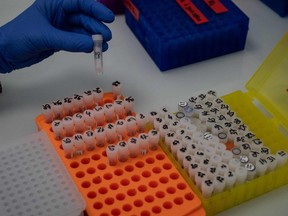 Researchers from the Auragen laboratory prepare the sequencing of human genomes to better identify rare diseases, in Lyon, France, Feb. 23, 2022.