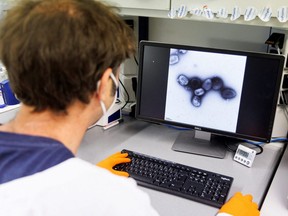 An employee of the vaccine company Bavarian Nordic shows a picture of a vaccine virus on a display in a laboratory of the company in Martinsried near Munich, Germany, May 24, 2022.