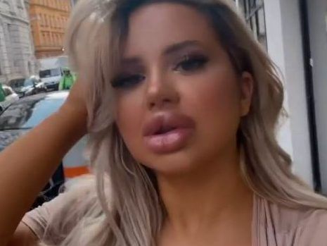 Extreme plastic surgery leads to family estrangement Toronto Sun