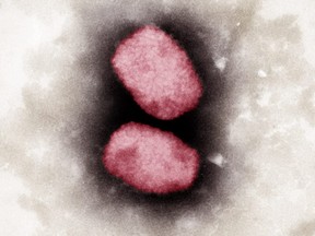 This handout photo taken in 2001 and received Monday, May 23, 2022 from the Robert Koch Institute, shows a coloured electron-microscopic capture of the monkeypox virus.