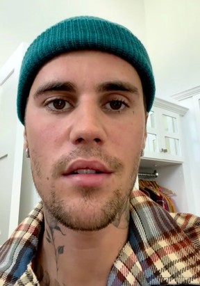 Justin Bieber ha revelado que tiene el síndrome de Ramsay Hunt.