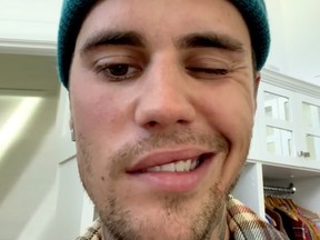 Justin Bieber revealed he has Ramsay Hunt syndrome in a social media post.