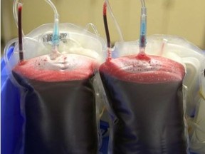 Units of donated blood are shown at a blood donor clinic in Calgary, on July 28, 2015