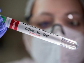 A test tube labelled "COVID-19 Test positive" is seen in this illustration picture taken March 10, 2021.