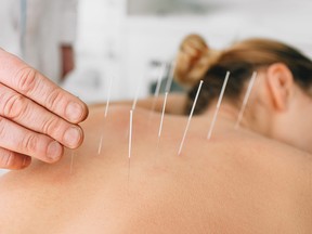 Acupuncturist inserts a needle into a woman's back.