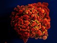 This handout photo made available by the U.S. National Institutes of Health shows a human white blood cell infected with the HIV virus.
