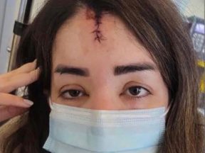 Elnaz Hajtamiri is seen after a Dec. 20, 2021 assault in her Richmond Hill parking garage.