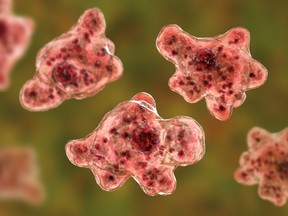 Brain-eating amoeba infection.