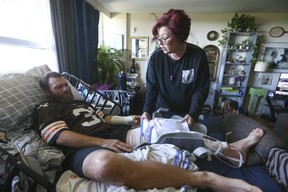 Justin Smith, 39, who has been bedridden since he was intentionally run down by a driver and left for dead last month, is recovering in his Etobicoke apartment with his wife Magda Szozda by his side on Friday, Sept. 23, 2022.