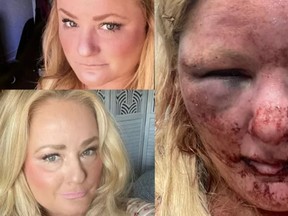 A California rape victim has shared horrific images of her facial injuries after she was assaulted on July 31.