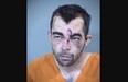 Mugshot of man wearing orange shirt with lacerations on face.