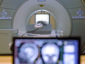 In this Nov. 26, 2014 file photo, a brain-scanning MRI machine at Carnegie Mellon University in Pittsburgh.&ampnbsp;Ontario is investing more than $20 million in operating costs to run 27 new magnetic resonance imaging machines across the province.