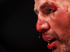 Blood drips off the nose of Glover Teixeira of Brazil in his light heavyweight title bout against Jiri Prochazka of the Czech Republic during UFC 275 at Singapore Indoor Stadium on June 12, 2022 in Singapore.