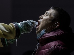 A man is given a nucleic acid test for COVID-19  by a health worker at a private testing site on Jan. 13, 2022 in Beijing.