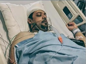 Abu Marzouk a subi plus de 10 fractures du crâne et a eu besoin de 62 points de suture lorsqu'il a été attaqué par deux frères Corhmazic dans le parking d'un parc de Mississauga le 15 juillet 2018.
