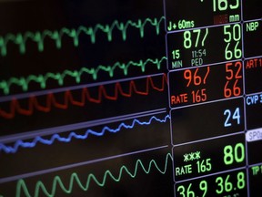 A screen displays a patient's vital signs during open heart surgery at the University of Maryland Medical Center in Baltimore on Nov. 28, 2016.