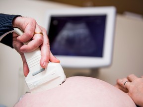 Illustration picture shows an ultrasound examination of a pregnant woman.