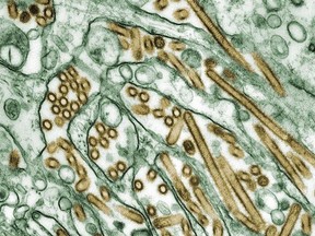 Colorized transmission electron micrograph of Avian influenza A H5N1 viruses (seen in gold) grown in MDCK cells (seen in green) as shown in this undated handout photo. The Canadian Food Inspection Agency says a domestic dog has been infected with H5N1 avian flu for the first time in Canada.