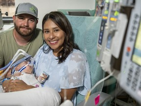 Jesse and Sandy Fuller held their twin daughters days after they were separated in a rare surgery.