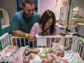 Jesse and Sandy Fuller check on their twin daughters before they were separated in a rare surgery. MUST CREDIT: Texas Children's Hospital photo