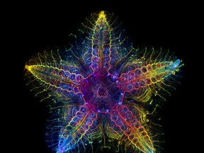 Laurent Formery of the United States captured this global-award-winning image. It shows the nervous system of a juvenile sea star (Patiria miniata). MUST CREDIT: Laurent Formery/Evident