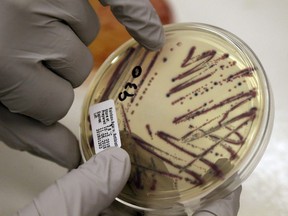 A microbiologist points out an isolated E. coli growth on an agar plate from a patient specimen at the Washington State Dept. of Health on Tuesday, Nov. 3, 2015, in Shoreline, Wash. A Calgary-based lawyer says she's preparing to file a class-action lawsuit following an E. coli outbreak linked to 11 daycares in the city.THE CANADIAN PRESS/AP-Elaine Thompson