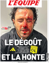 L’Equipe newspaper’s front page Oct. 30, 2023 with a picture of Fabio Grosso’s bloodied face.