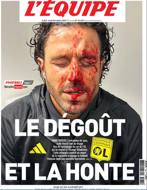 L’Equipe newspaper’s front page Oct. 30, 2023 with a picture of Fabio Grosso’s bloodied face.