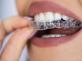 Clear aligner dental night guard for teeth/